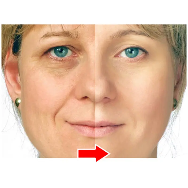 Rejunvenx Advanced Repair Cream (10 Ml) 1